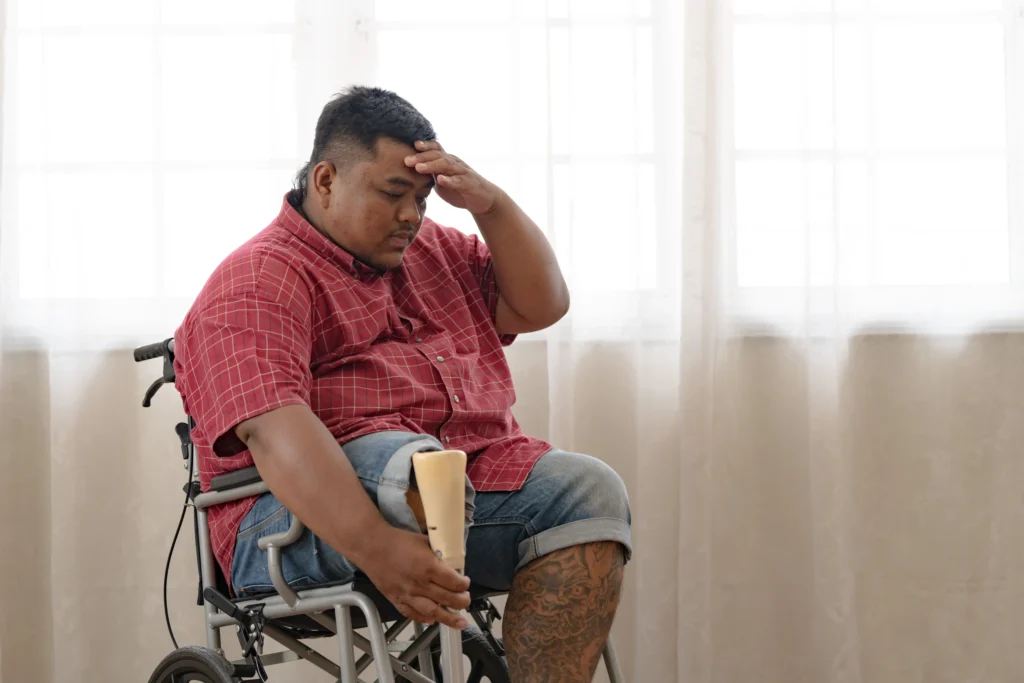 A man in a red plaid shirt and denim shorts sits in a wheelchair indoors. He has a prosthetic limb on his right leg and a tattoo on his left leg. He is looking down with his hand on his forehead, appearing distressed or exhausted.